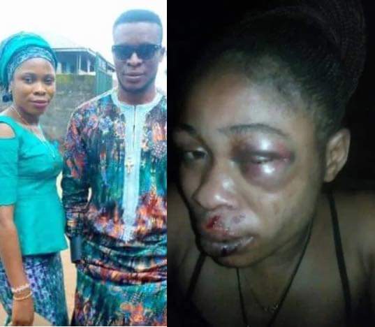  Man brutalises wife for refusing to abort pregnancy