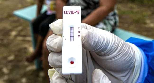  35 Doctors Test Positive For COVID-19 In Kwara