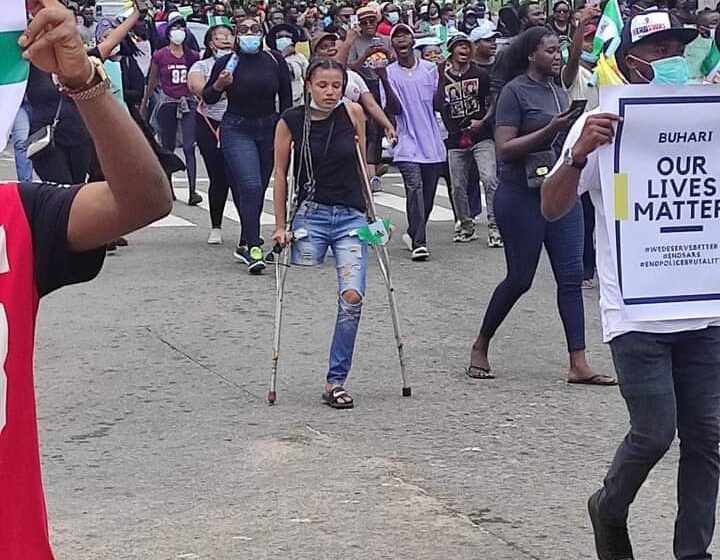  #ENDSARS  protesters raise ₦2.8m for disabled Jane to acquire artificial legs