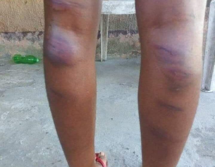 Teacher allegedly brutalizes student for failing to submit assignment