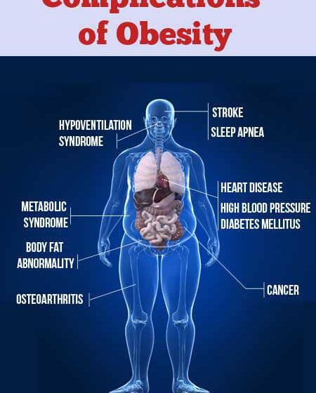  Medical expert lists ways to control obesity