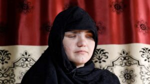 2_Afghan-police-woman-who-was-blinded-after-gunmen-attack-interviewed-in-Kabul