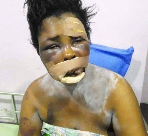  My “Yahooboy” son tried to remove my eyes for ritual -Woman narates her story after narrow escape