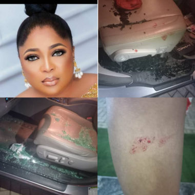  Actress Kemi Afolabi attacked, injured with car vandalized by thieves in Lagos