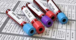 brazilian-man-could-be-first-ever-cured-of-hiv-with-drugs-alone_resize_md