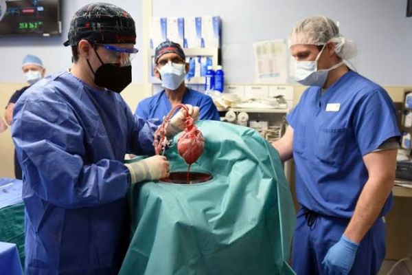  Man who got 1st pig heart transplant dies after 2 months