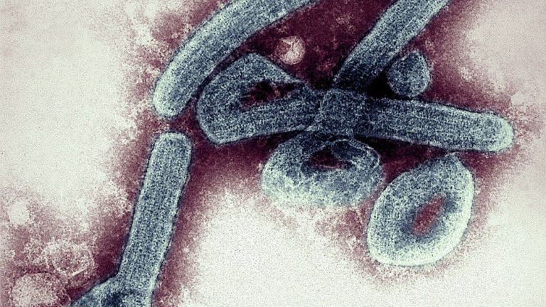 Ghana confirms first two cases of deadly Marburg virus